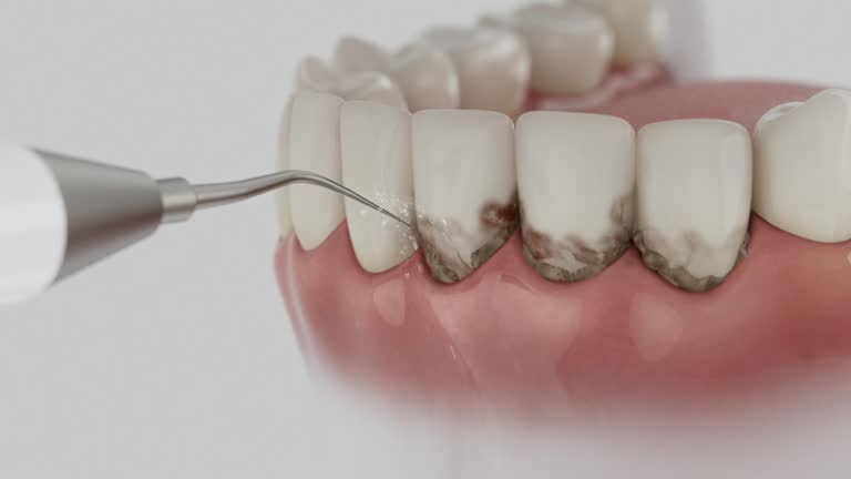 Reliable Dental Implants contractor in Eleanor, WV by Smile Center Dentistry